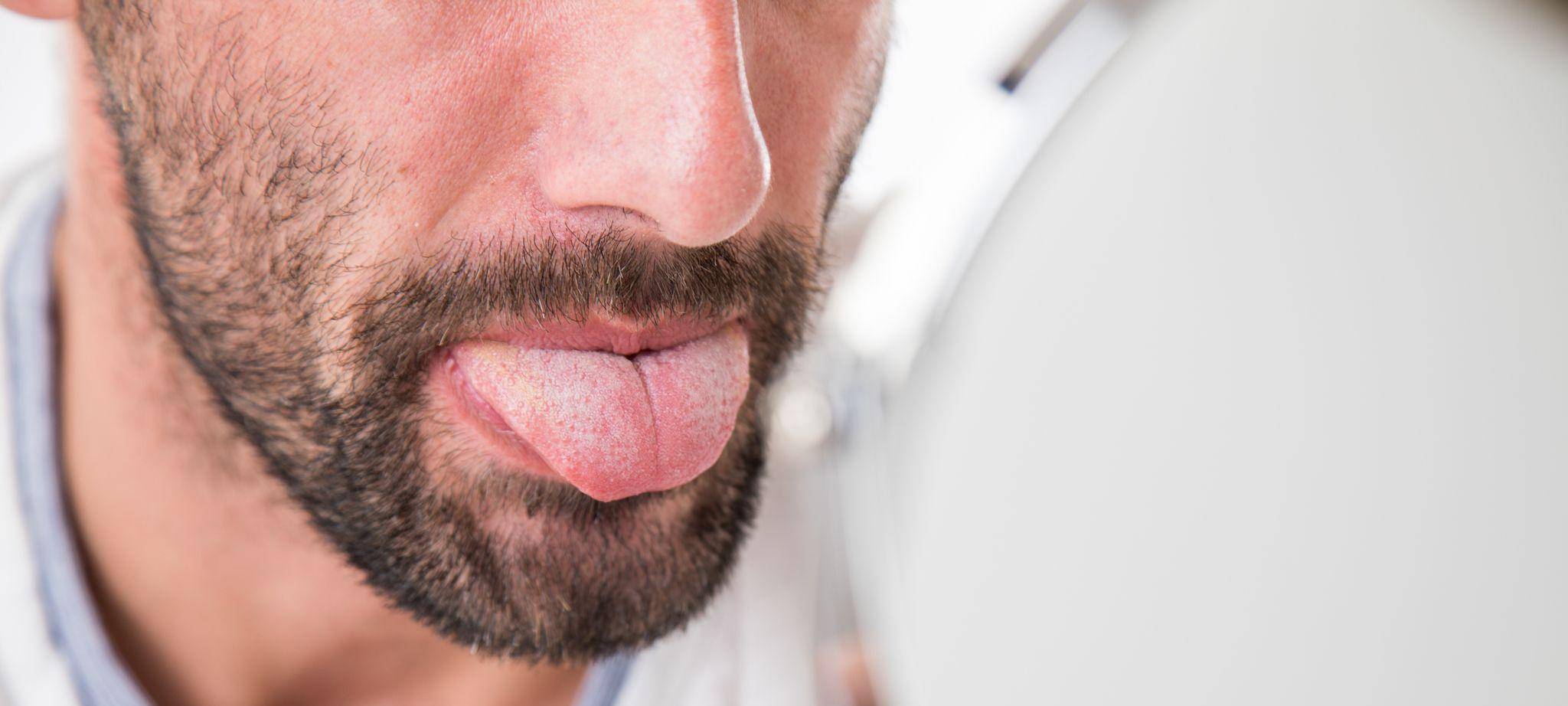 Mann betrachtet seine Zunge im Spiegel